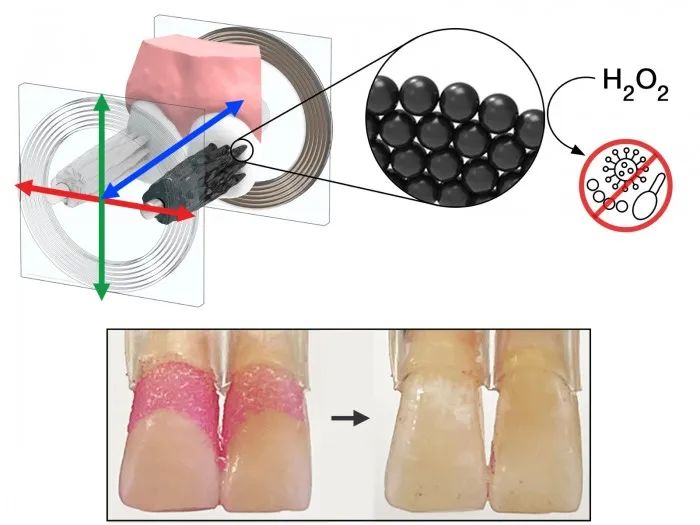 科学家开发可变形的微型机器人 可以刷牙和使用牙线