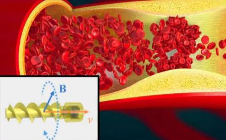 一场属于机器鱼的“奇幻漂流”，可在细小血管中“逆流而上”！